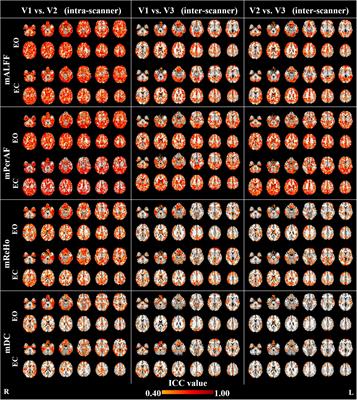 Intra- and Inter-Scanner Reliability of Voxel-Wise Whole-Brain Analytic Metrics for Resting State fMRI